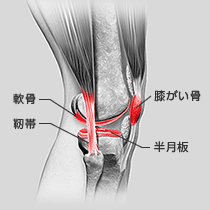 一つではないひざの痛みの原因